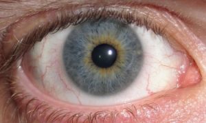 What is Iridology